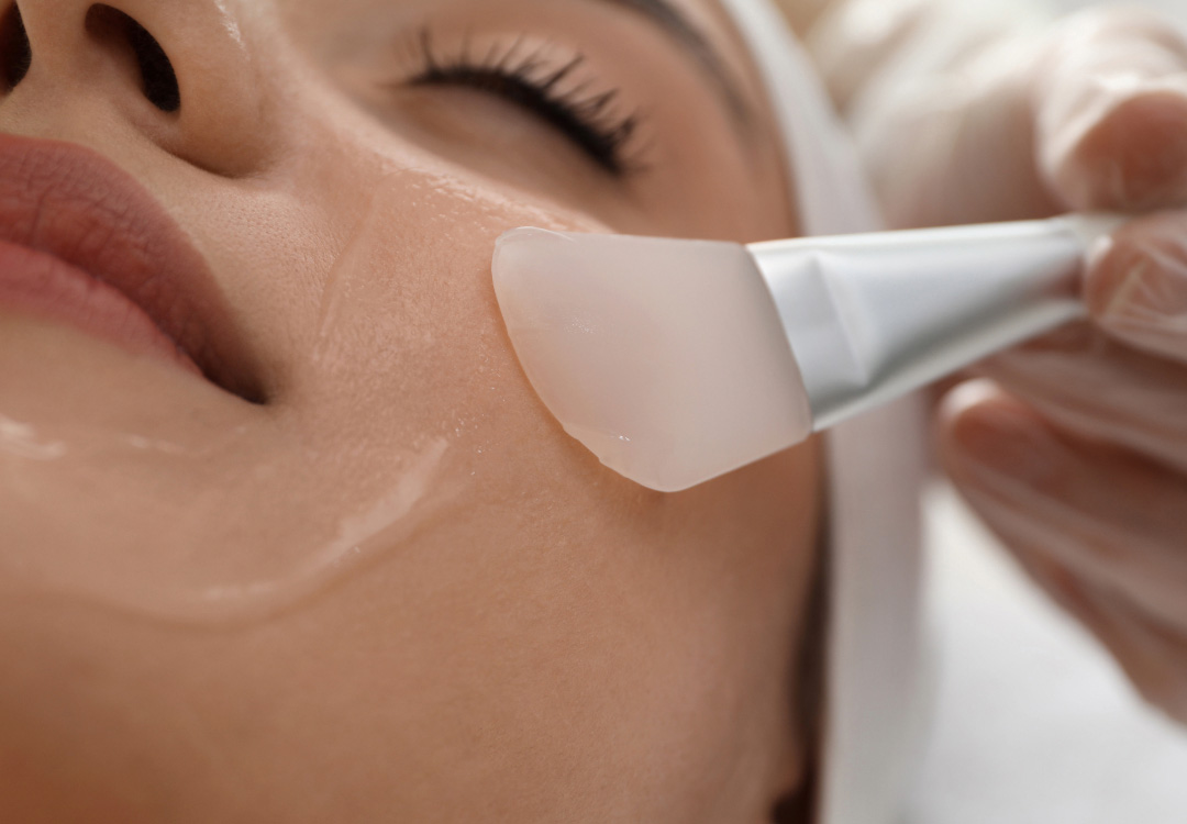 imagen peeling facial Valladolid imagen peeling facial Valladolid