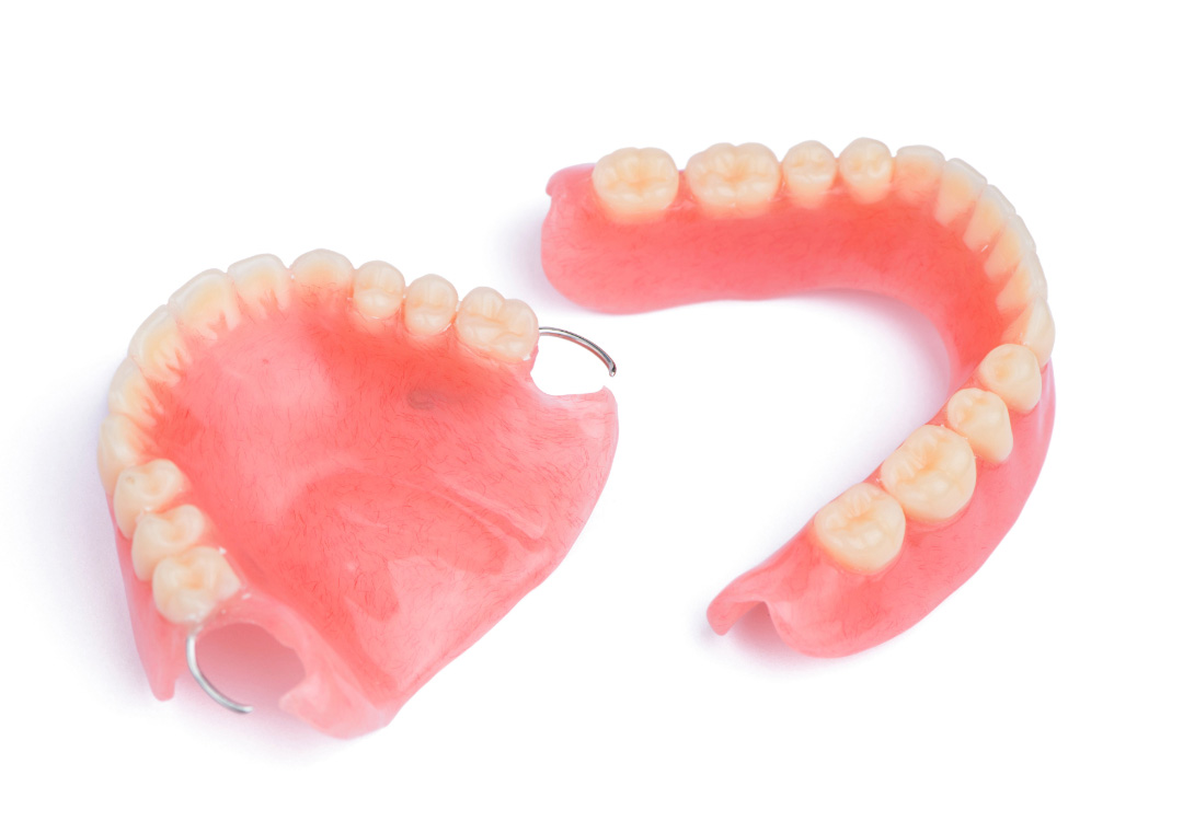 imagen prótesis dental Valladolid imagen prótesis dental Valladolid