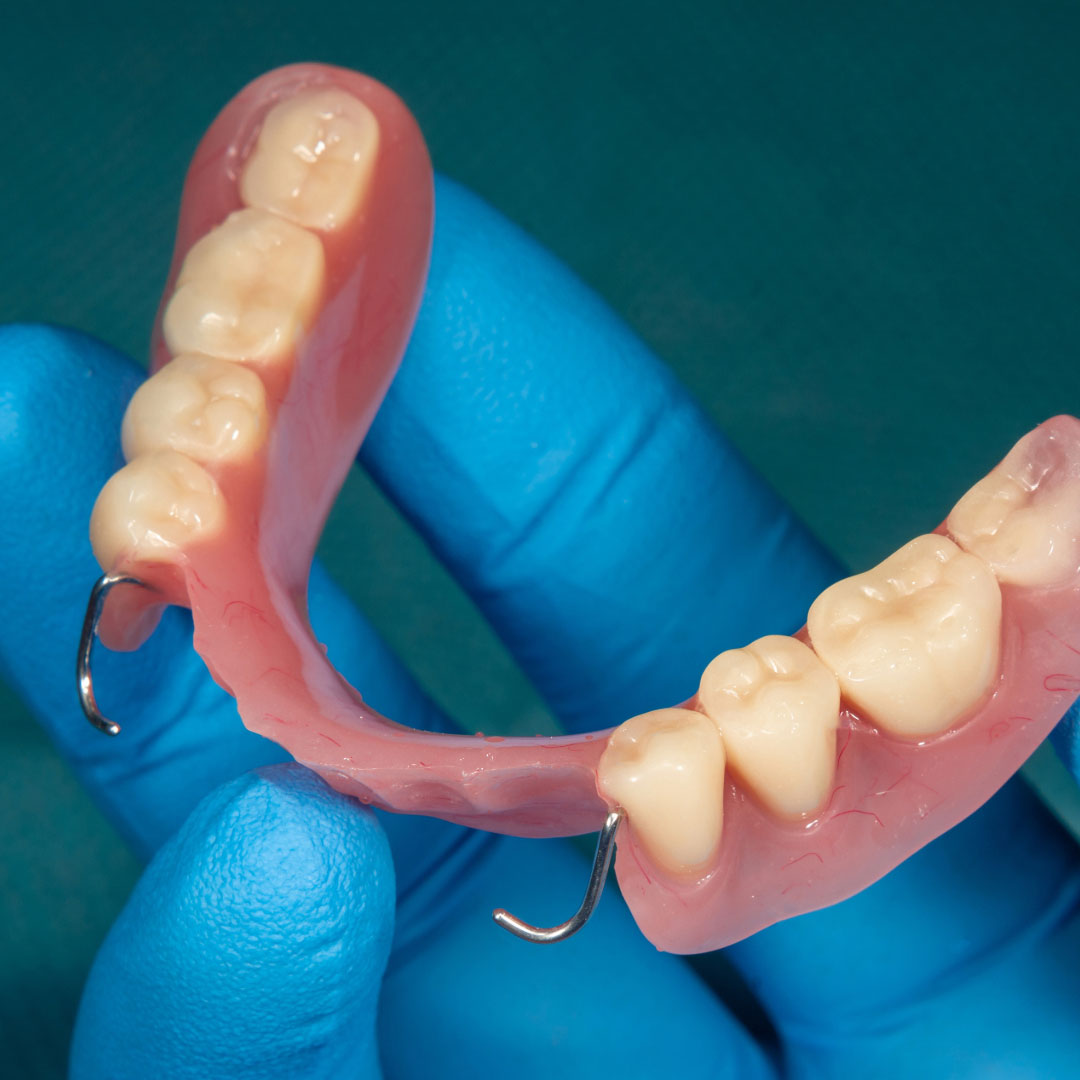imagen prótesis dental Valladolid